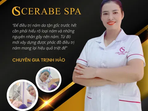 Chuyên gia Trịnh Hảo thực hiện điều trị nám chuẩn y khoa tại Cerabe Spa cơ sở 14